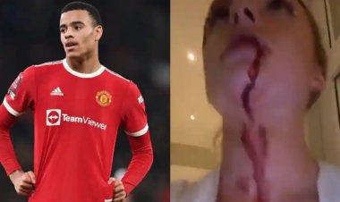 صديقة نجم مانشستر يونايتد تتهمه بالاعتداء الجسدي.. والنادي يرد