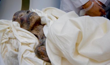 زاهى حواس يصطحب مومياء فرعونية لفحصها في مستشفى الأورام بالأقصر