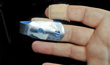 عض إصبع المدير.. مسئول مطعم يتهم عامل بقضم عقلة من يده بالزمالك