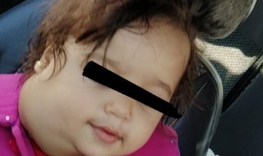 وزنه كيلو إلا ربع.. فريق طبي بجامعة الإسكندرية ينجح فى إزالة ورم من رقبة رضيع