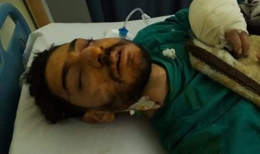 «ضربني قلمين».. مبيض محارة يشوه محاسب ويصيبه بـ 100 غرزة في الوجه بـمصر القديمة