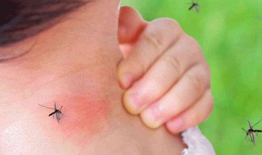 تعرف على أسباب تعرضك للناموس أكثر من غيرك