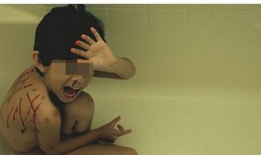 بعد وفاة الأم.. إنقاذ طفل من تعذيب زوجة الأب في كفر الشيخ