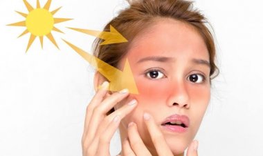 تعرف على أضرار الشمس بالبشرة