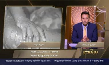 متحدث الصحة: جدري القرود لن يكون وبائيًا