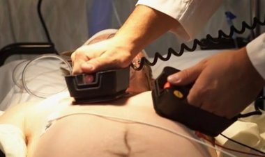 نجاح فريق طبي بمستشفى كفر الدوار فى إعادة مريض للحياة بعد توقف قلبه ٣٥ دقيقة