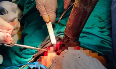 الفريق الطبي بمستشفى الدلنجات ينجح فى إنقاذ حياة مواطن بعد إصابته بطعنة نافذة بسلاح أبيض 