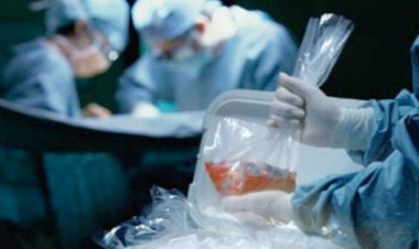 الكلى بـ20 ألف.. رفض استئناف المتهمين بالاتجار في الأعضاء البشرية