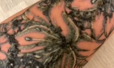 وشم يمنع سيدة بريطانية من ثني ذراعها ويصيبها بعدوى شديدة