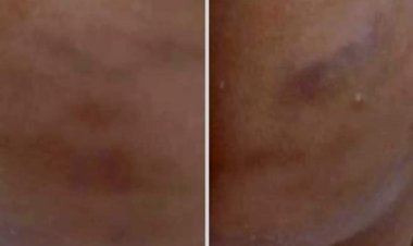 كشف حقيقة تعذيب أطفال دار أيتام بالتجمع الخامس