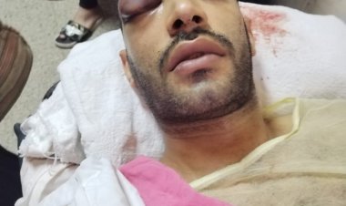 «أصابه بارتجاج بالمخ ونزيف».. شخص يعتدي على زوج طليقته بالغربية