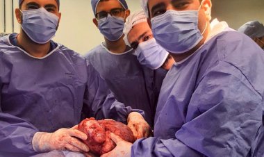 يزن 4 كيلو.. استئصال ورم بالصدر لمريض داخل مستشفى جامعة المنوفية