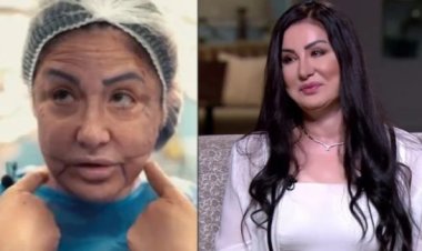 وفاء سالم عن تشوه وجهها بسبب عمليات التجميل: «الصديد كاد يصل للمخ والشبكية وربنا أنقذ حياتي»