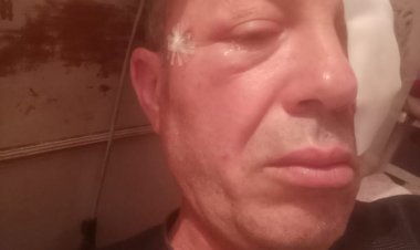 إصابة قائد قطار اكسبريس «شربين/ طنطا» بعد إلقاء حجارة عليه