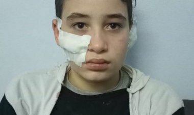 «أمه قالتله هات وشه».. طالب إعدادي يتعدى على زميله بـ«كتر» بالمحلة لخلافات سابقة بينهم «خاص»