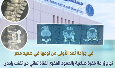 فريق جراحة المخ والأعصاب بمستشفى الكرنك الدولي بالأقصر ينجح في إجراء عملية خطيرة