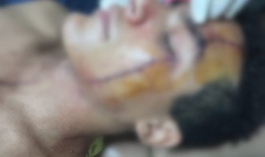 «افتكروه أخوهم  التوأم».. 4 شباب يعتدون بالضرب على شاب بروض الفرج