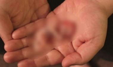 ضبط طبيب شهير يجري عمليات إجهاض ويحرق الأجنة داخل مركز بكرداسة