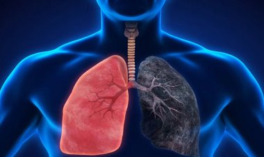 ثالث سبب للوفاة بالعالم.. ما هو مرض الانسداد الرئوي؟