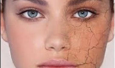 5 وصفات طبيعية  لتحافظي على  بشرتك في الشتاء