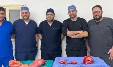 استئصال ورم خبيث يزن 10 كيلو جرامات من مريضة بالخانكة