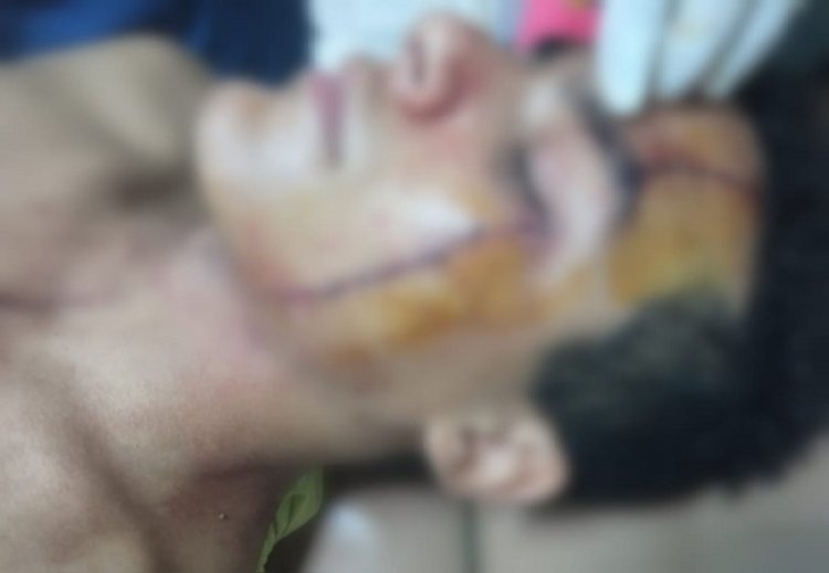 «افتكروه أخوهم التوأم».. 4 شباب يعتدون بالضرب على شاب بروض الفرج