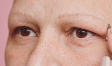 وصفات طبيعية تمنع تساقط الحواجب .. تعرفي عليها