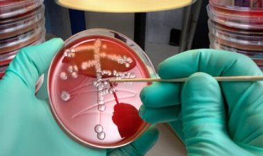 فريق طبي أمريكي يبتكر اختبارا للتفريق بين العدوى الفيروسية والبكتيرية.. هل سيودع العالم المضادات الحيوية؟