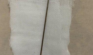 عملية جراحية في البحيرة لاستخراج «إبرة» من عضو ذكري.. والمريض: «كان مسدود وبسلكه»