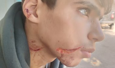 حدث في المعهد الأزهرى بقرية كفر طحا بشبين القناطر.. رفض يغششه في الامتحان فمزق وجهه بسلاح أبيض