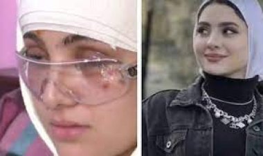 ليلة فقدت فيها «سارة» نظرها.. مُسحلين يتهجمون على البلوجر وخطيبها.. والفتاة تقدم روحها فداءً له