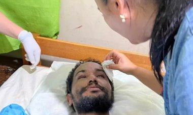 فقد بغابات الأمازون.. قصة رجل شرب الماء من حذائه