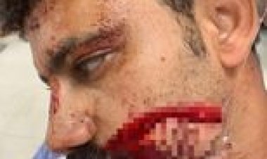 120 غرزة تسرد بطوله  «فرج» في السوق: «كنت بحاول ابني مستقبلي» (فيديو)