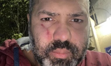 إصابة الملحن محمود الخيامي في مشاجرة  بالهرم 