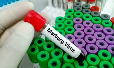 فيروس ماربورغ يتفشى في دولتين أفريقيتين .. ماذا نعرف عنه ؟