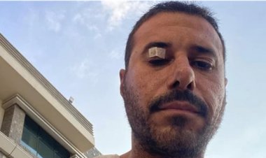 بعد إصابته بعينه.. رسالة  من أحمد السعدني إلى خالد يوسف