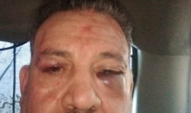 «العاصمة» فجرّت القضية.. داعية يتطاول بالضرب على غيره.. والأمن ينصب له فخًا