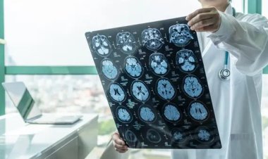 رغم وجود الجين المسبب للإصابة.. الحالة الثانية تنجح في مقاومة مرض الزهايمر