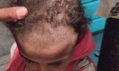 ننشر قررات النيابة بواقعة تعذيب طفلة على يد زوجة والدها بقنا