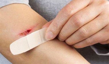استخدم ضمادات الجروح.. تعالج سريعًا وتحمي من الالتهابات