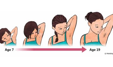 أضرار البلوغ المبكر أو المتأخر عند الفتيات.. طبيب يوضح أسبابه ومظاهره