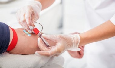 تعرف على شروط التبرع بالدم