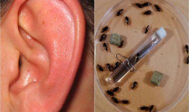 عائلة كاملة من الصراصير تعيش في أذن رجل صيني..ما الحكاية؟