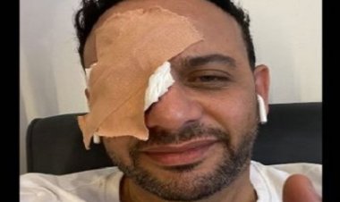 بسبب خالد سرحان.. مصطفى قمر يتعرض لإصابة في عينه خلال تصوير «حريم كريم 2»