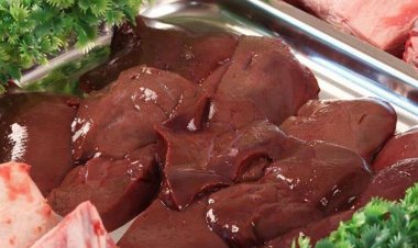 «فيها ديدان».. استشاري تغذية يُحذر من أكل «الكبدة نيئة»