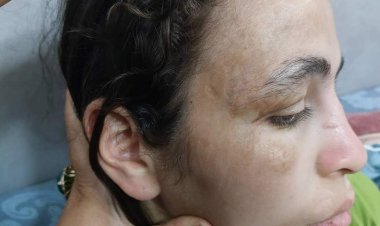 أمن القاهرة يكشف حقيقة تعذيب فتاة في المقطم من ذوي الهمم