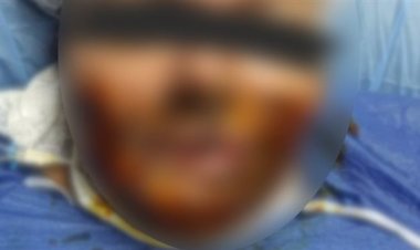 بسبب خلافات على الميراث.. نقاش يشوه جسد  شقيقته وزوجها بماء النار في منشأة ناصر