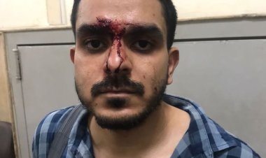 محامي يعتدي على صحفي بـ «الضرب» داخل منزله في حلوان