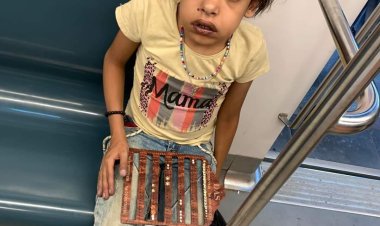 عميد معهد القلب السابق يتعهد بعلاج بائعة المترو