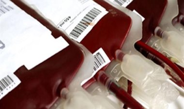 لأول مرة.. تفاصيل تصنيع أكياس الدم في مصر